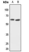 1 - Anti-MMP14 Antibody AP51349
