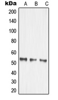 1 - Anti-MMP14 Antibody AP51350