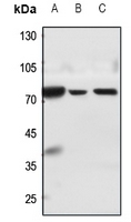 1 - Anti-MMP15 Antibody AP51351