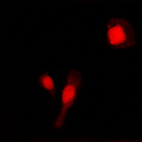 3 - Anti-MMP2 Antibody AP51352