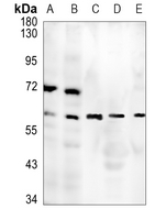 1 - Anti-MMP2 Antibody AP51352