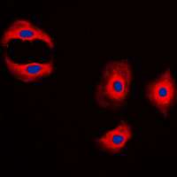 3 - Anti-MMP3 Antibody AP51354