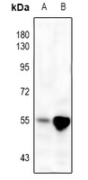 1 - Anti-MMP3 Antibody AP51354