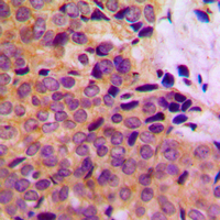 19 - Anti-MMP8 Antibody AP51356