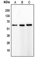 1 - Anti-MMP8 Antibody AP51356