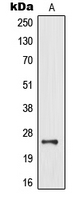 1 - Anti-MOB3B Antibody AP51357