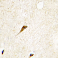19 - Anti-MOK Antibody AP51358