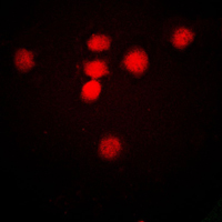 3 - Anti-MRE11 Antibody AP51361