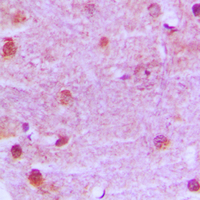 19 - Anti-MRE11 Antibody AP51361