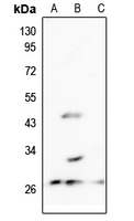 1 - Anti-MRPL10 Antibody AP51362