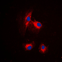 3 - Anti-MRPL15 Antibody AP51363