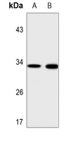1 - Anti-MRPL15 Antibody AP51363