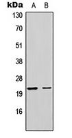 1 - Anti-MRPL17 Antibody AP51364