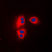 3 - Anti-MRPL32 Antibody AP51365