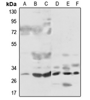 1 - Anti-MRPL46 Antibody AP51366