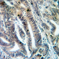 19 - Anti-MRPS12 Antibody AP51367