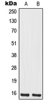 1 - Anti-MRPS12 Antibody AP51367