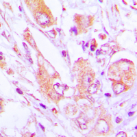 19 - Anti-MRPS35 Antibody AP51368