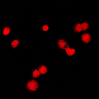 3 - Anti-MSH6 Antibody AP51369