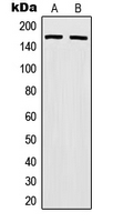 1 - Anti-MSH6 Antibody AP51369