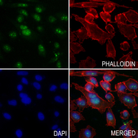 3 - Anti-MT-ND1 Antibody AP51370