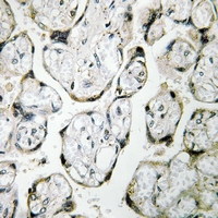 19 - Anti-MT-ND1 Antibody AP51370