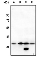 1 - Anti-MT-ND1 Antibody AP51370