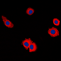 3 - Anti-MUC16 Antibody AP51371