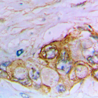 19 - Anti-MUC16 Antibody AP51371