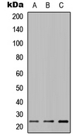 1 - Anti-MUC16 Antibody AP51371