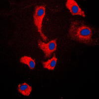 3 - Anti-MYD88 Antibody AP51372