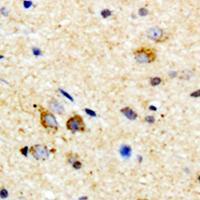 19 - Anti-MYD88 Antibody AP51372