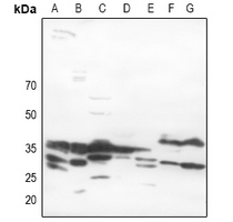 1 - Anti-MYD88 Antibody AP51372