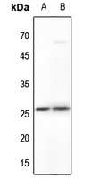 1 - Anti-MYF5 Antibody AP51373