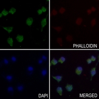 3 - Anti-MYOM2 Antibody AP51375
