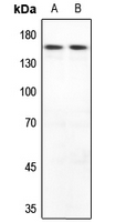 1 - Anti-MYOM2 Antibody AP51375