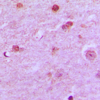 19 - Anti-N4BP1 Antibody AP51377