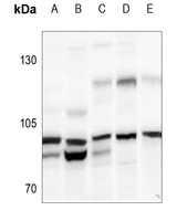 1 - Anti-N4BP1 Antibody AP51377