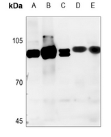 1 - Anti-NCAPH Antibody AP51378