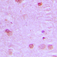 19 - Anti-NCOA7 Antibody AP51379