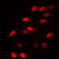 3 - Anti-NCOR1 Antibody AP51380