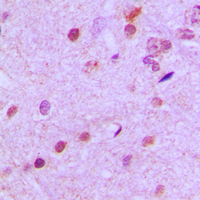 19 - Anti-NEUROD2 Antibody AP51386