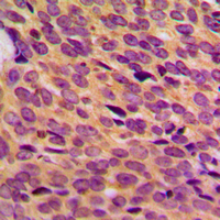 19 - Anti-NF1 Antibody AP51387