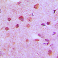 19 - Anti-NFYC Antibody AP51389