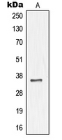 1 - Anti-NKX3-1 Antibody AP51391