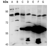 1 - Anti-NOC3L Antibody AP51392