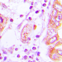 19 - Anti-iNOS Antibody AP51393