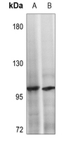1 - Anti-NOTCH2 Antibody AP51394