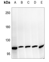 1 - Anti-NOTCH2 Antibody AP51395