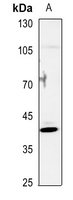 1 - Anti-NR2F6 Antibody AP51398